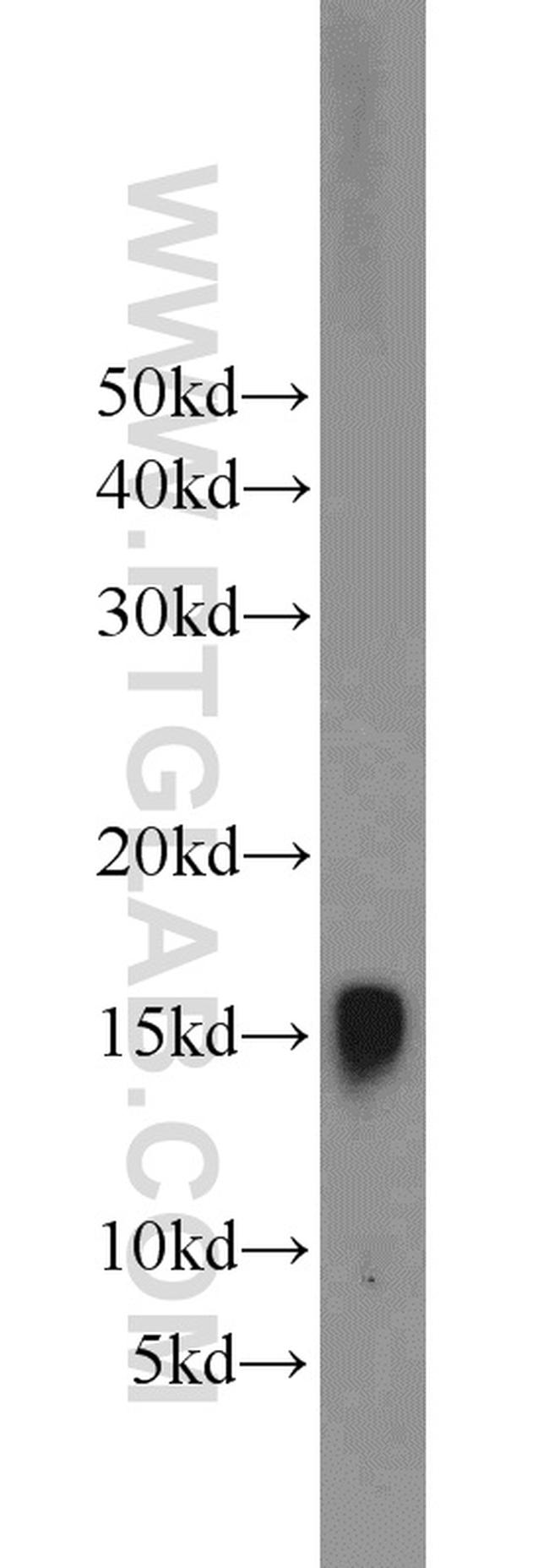 Hemoglobin alpha Antibody in Western Blot (WB)