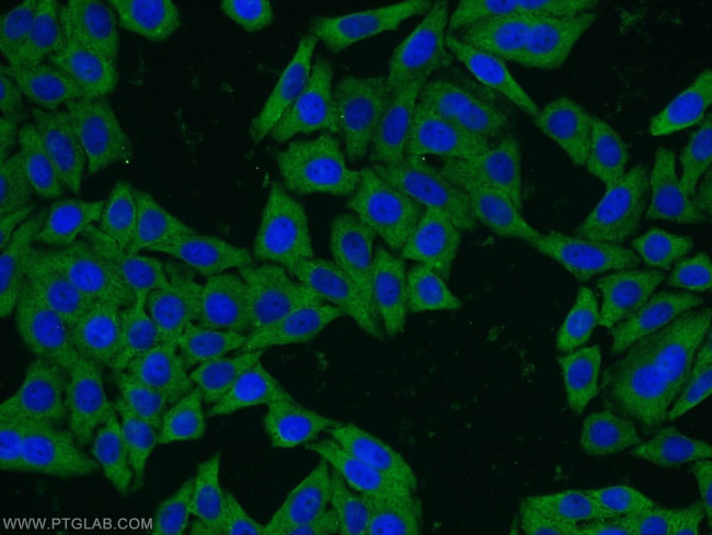 TCP10 Antibody in Immunocytochemistry (ICC/IF)