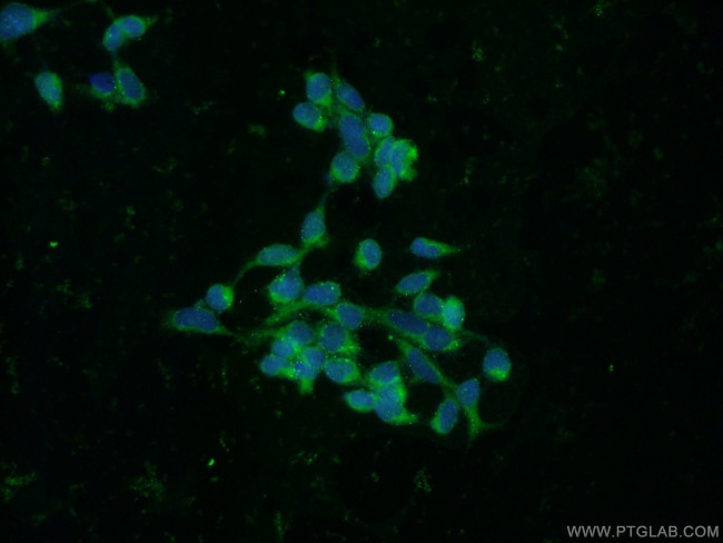 RBP7 Antibody in Immunocytochemistry (ICC/IF)