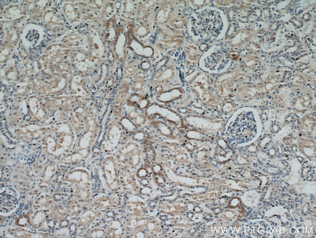 RBP7 Antibody in Immunohistochemistry (Paraffin) (IHC (P))