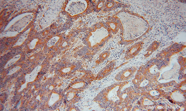 RBP7 Antibody in Immunohistochemistry (Paraffin) (IHC (P))