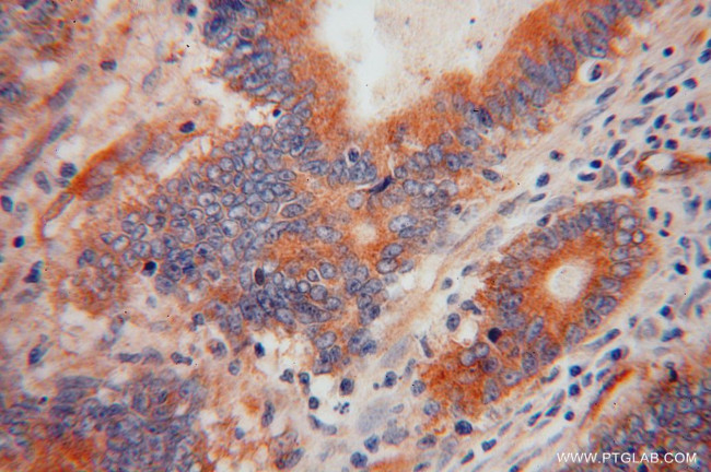 RBP7 Antibody in Immunohistochemistry (Paraffin) (IHC (P))