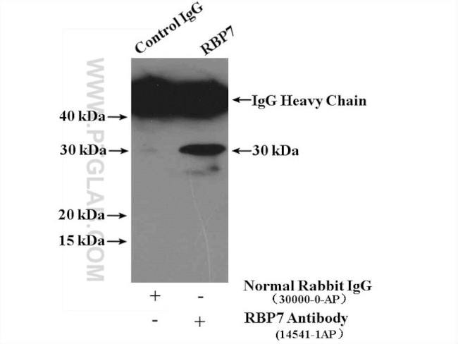 RBP7 Antibody in Immunoprecipitation (IP)