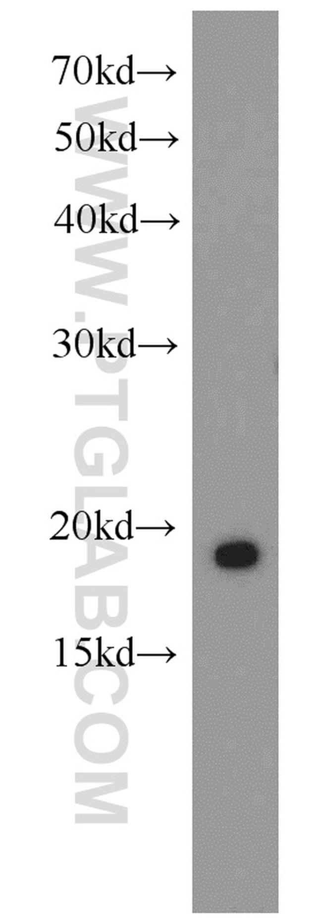 RBP7 Antibody in Western Blot (WB)