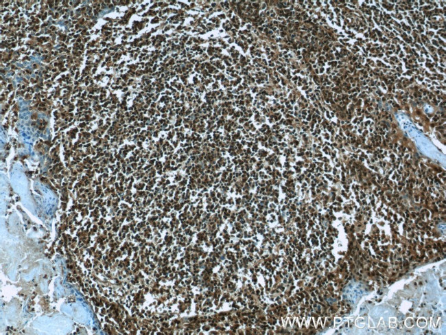 LMP2 Antibody in Immunohistochemistry (Paraffin) (IHC (P))