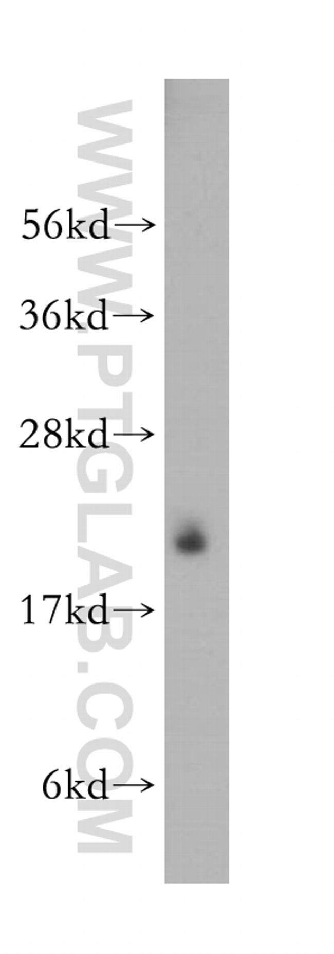 LMP2 Antibody in Western Blot (WB)