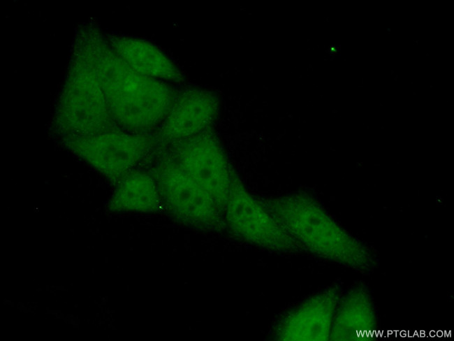 LMP2 Antibody in Immunocytochemistry (ICC/IF)