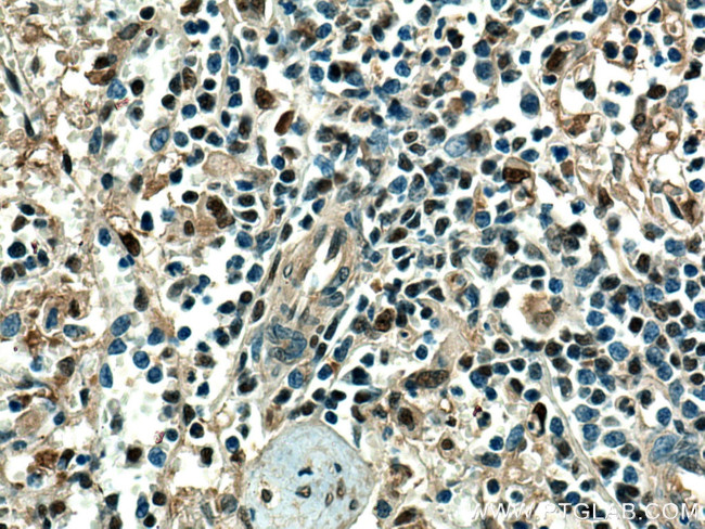 LMP2 Antibody in Immunohistochemistry (Paraffin) (IHC (P))