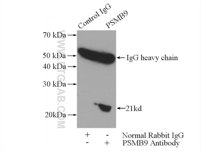 LMP2 Antibody in Immunoprecipitation (IP)