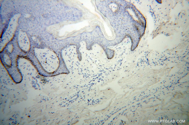 MSRA Antibody in Immunohistochemistry (Paraffin) (IHC (P))