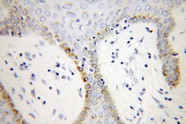 MSRA Antibody in Immunohistochemistry (Paraffin) (IHC (P))