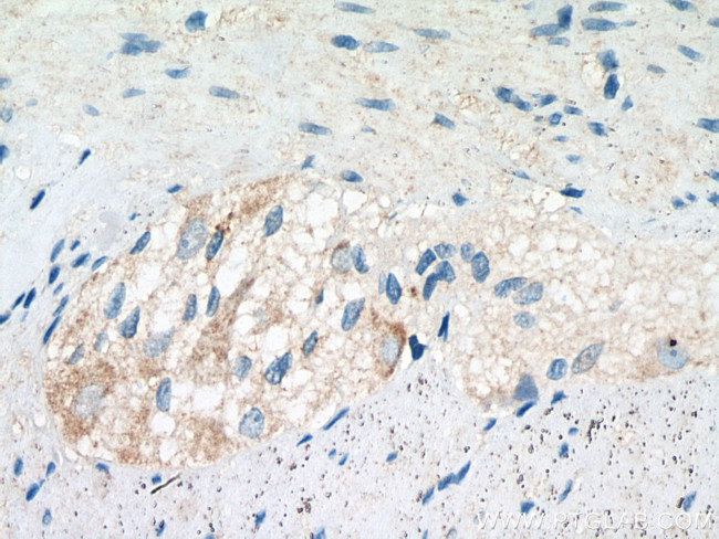 MSRA Antibody in Immunohistochemistry (Paraffin) (IHC (P))