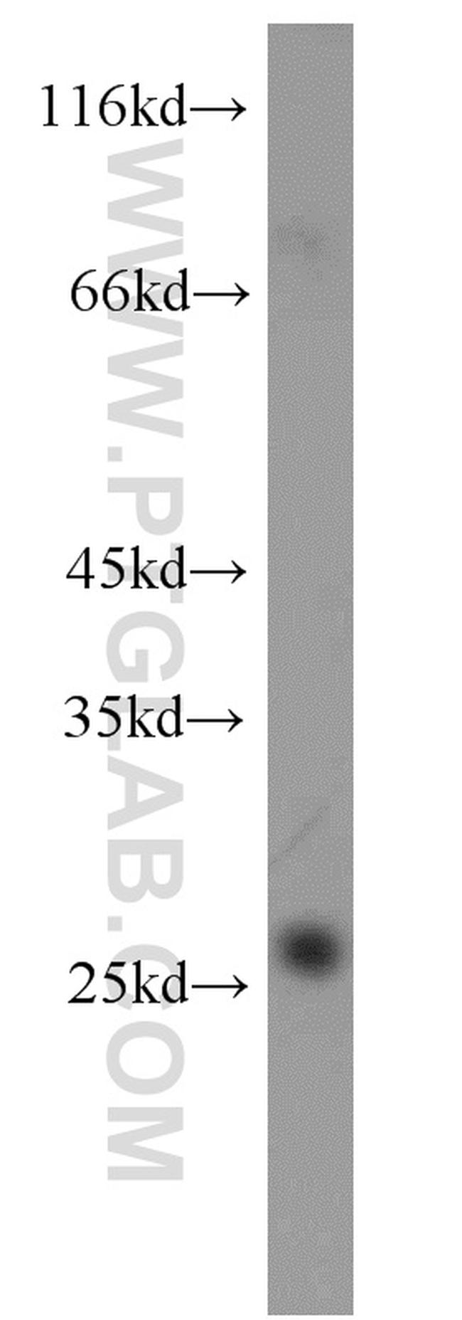 MSRA Antibody in Western Blot (WB)