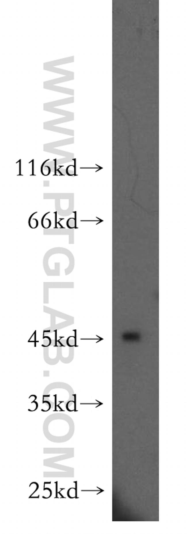 ARFIP2 Antibody in Western Blot (WB)