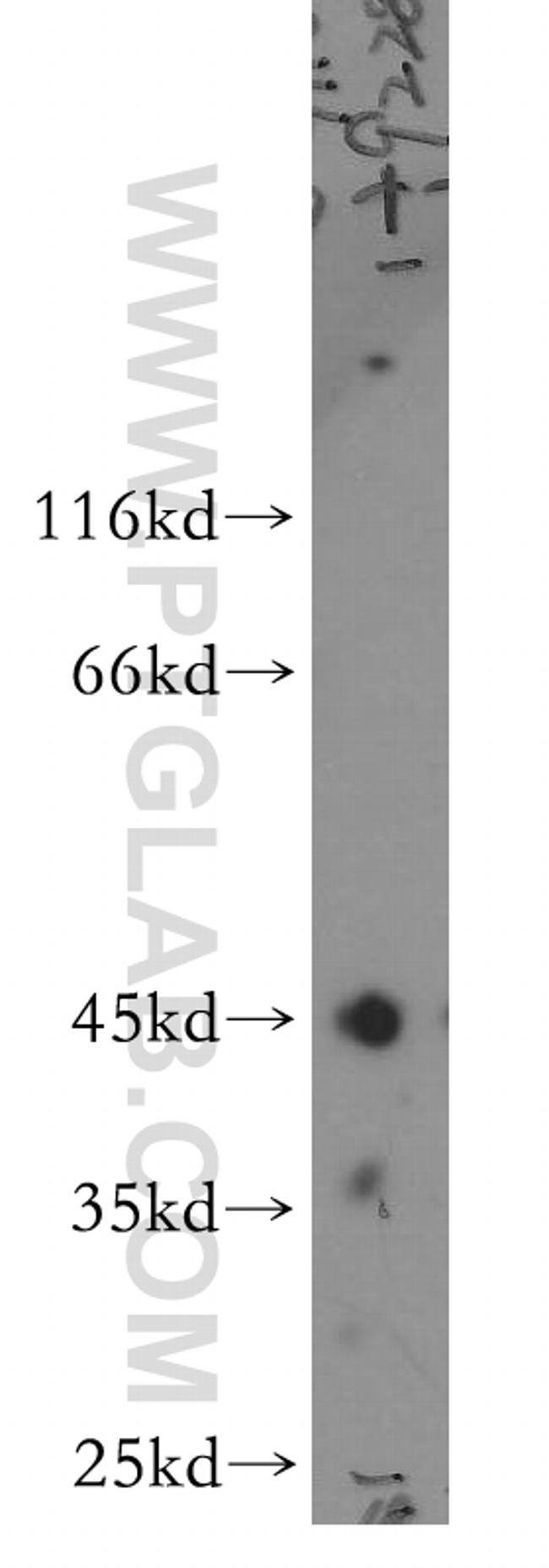 ARFIP2 Antibody in Western Blot (WB)