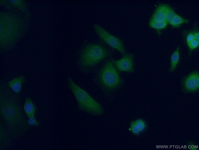 AFP Antibody in Immunocytochemistry (ICC/IF)