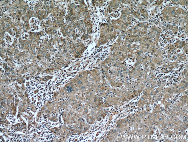 AFP Antibody in Immunohistochemistry (Paraffin) (IHC (P))