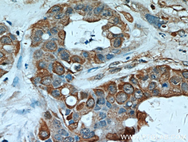 AFP Antibody in Immunohistochemistry (Paraffin) (IHC (P))