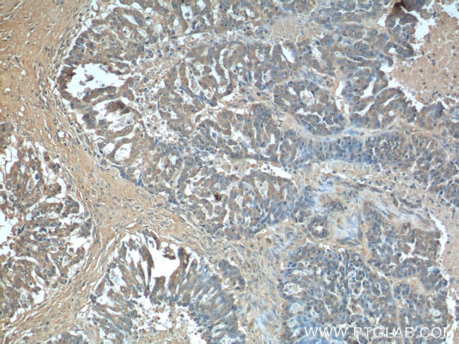 AFP Antibody in Immunohistochemistry (Paraffin) (IHC (P))