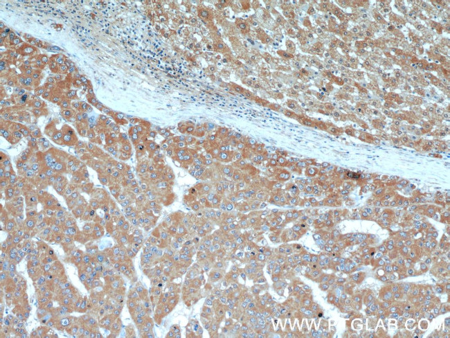 AFP Antibody in Immunohistochemistry (Paraffin) (IHC (P))