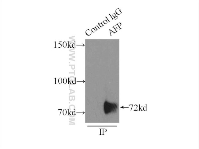 AFP Antibody in Immunoprecipitation (IP)