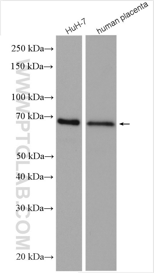 AFP Antibody in Western Blot (WB)