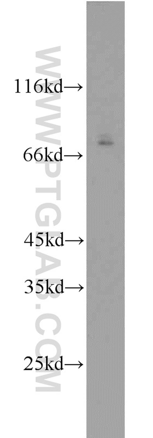 AFP Antibody in Western Blot (WB)