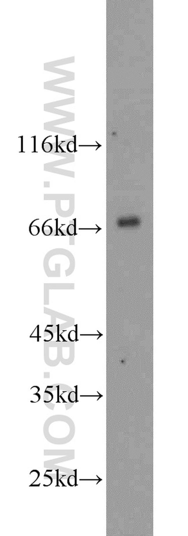 AFP Antibody in Western Blot (WB)