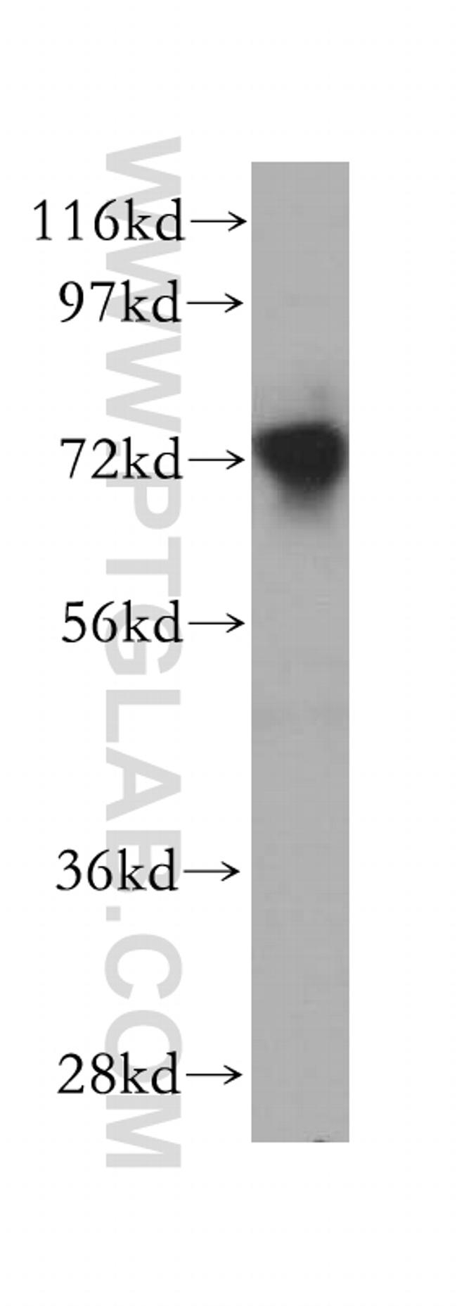 AFP Antibody in Western Blot (WB)