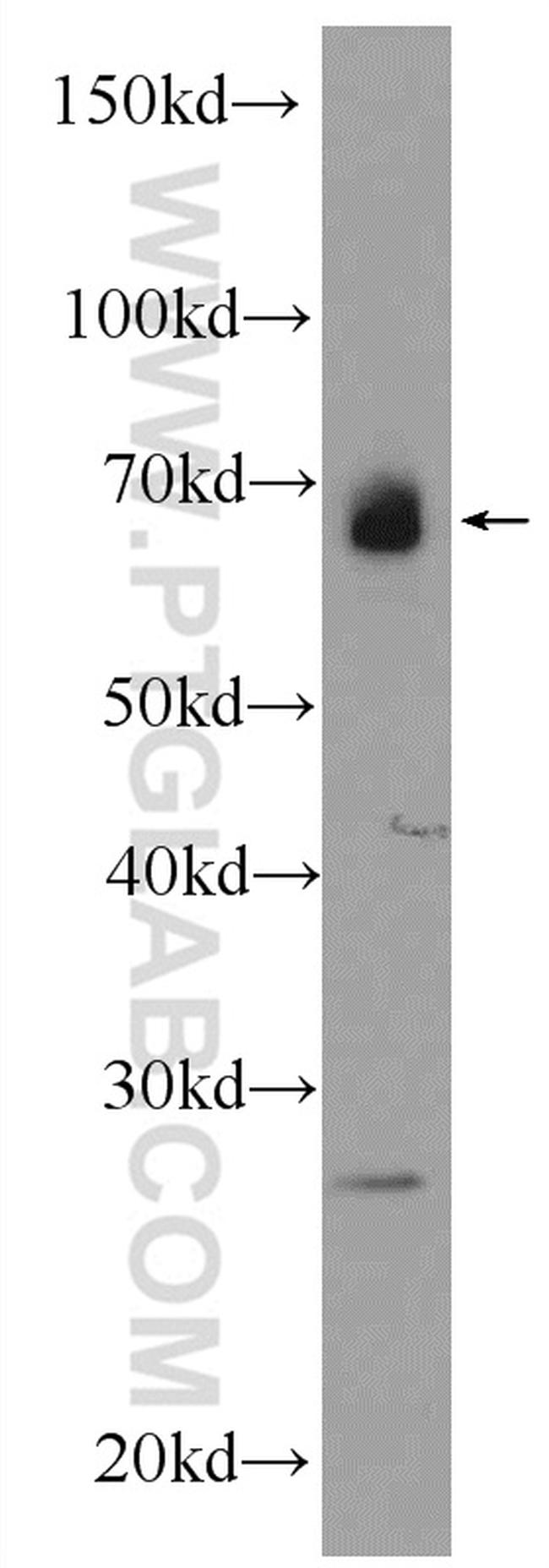 AFP Antibody in Western Blot (WB)