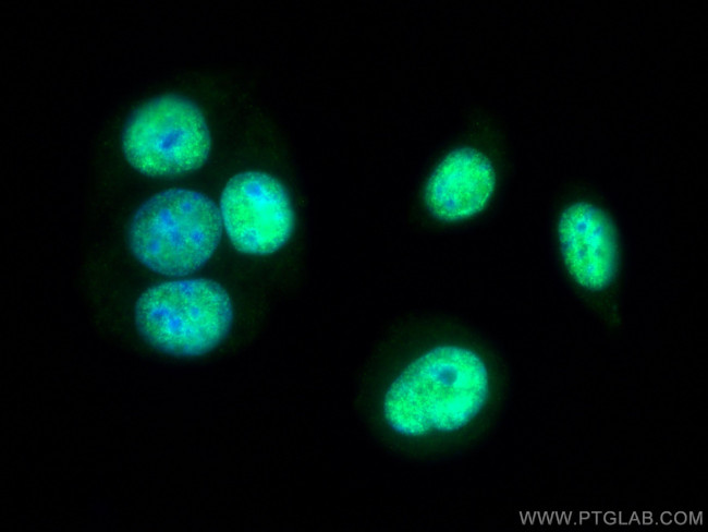 NACC1 Antibody in Immunocytochemistry (ICC/IF)