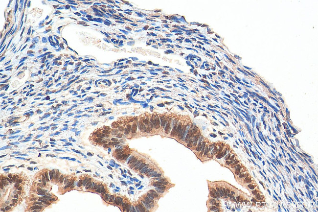 NACC1 Antibody in Immunohistochemistry (Paraffin) (IHC (P))