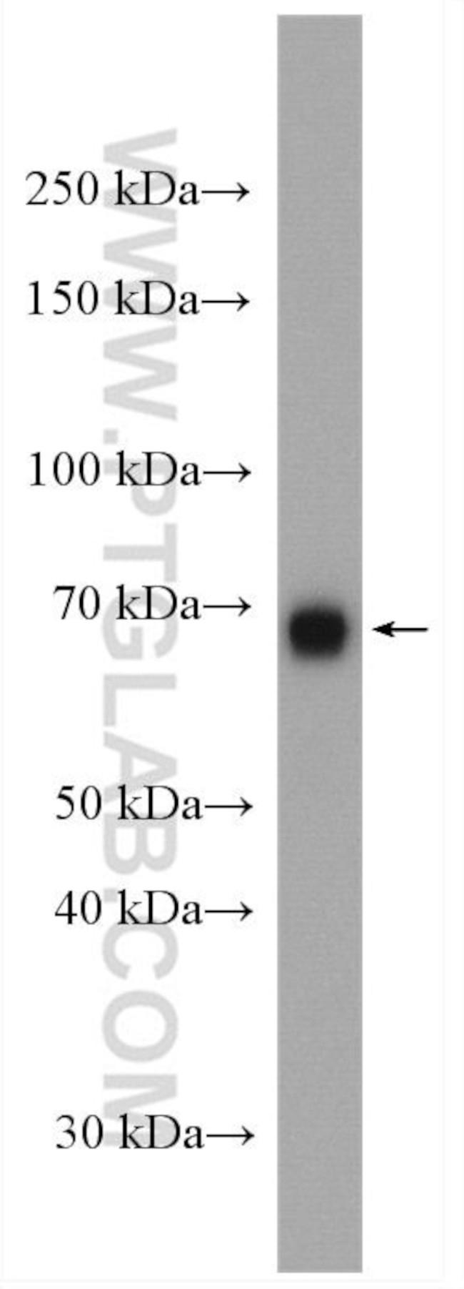 NACC1 Antibody in Western Blot (WB)