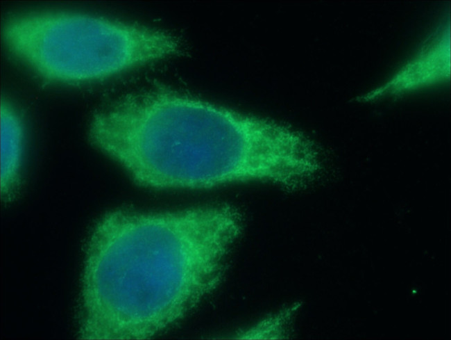 MT1-MMP Antibody in Immunocytochemistry (ICC/IF)