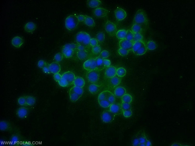 MT1-MMP Antibody in Immunocytochemistry (ICC/IF)