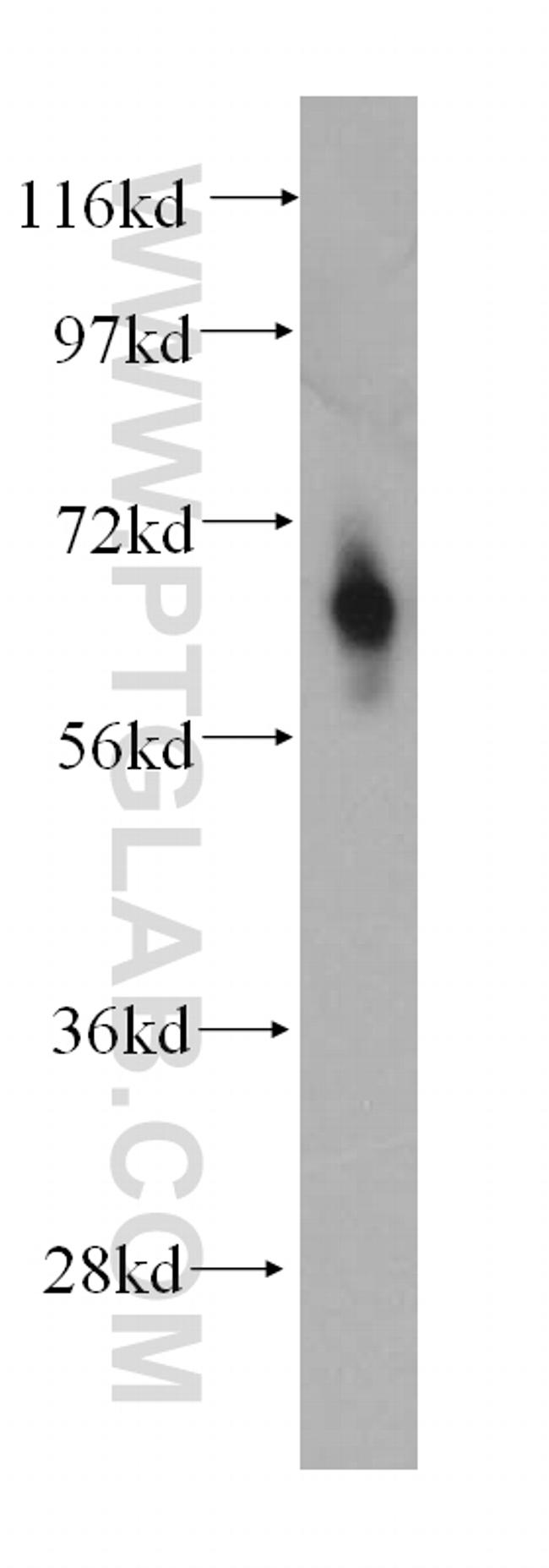 MT1-MMP Antibody in Western Blot (WB)