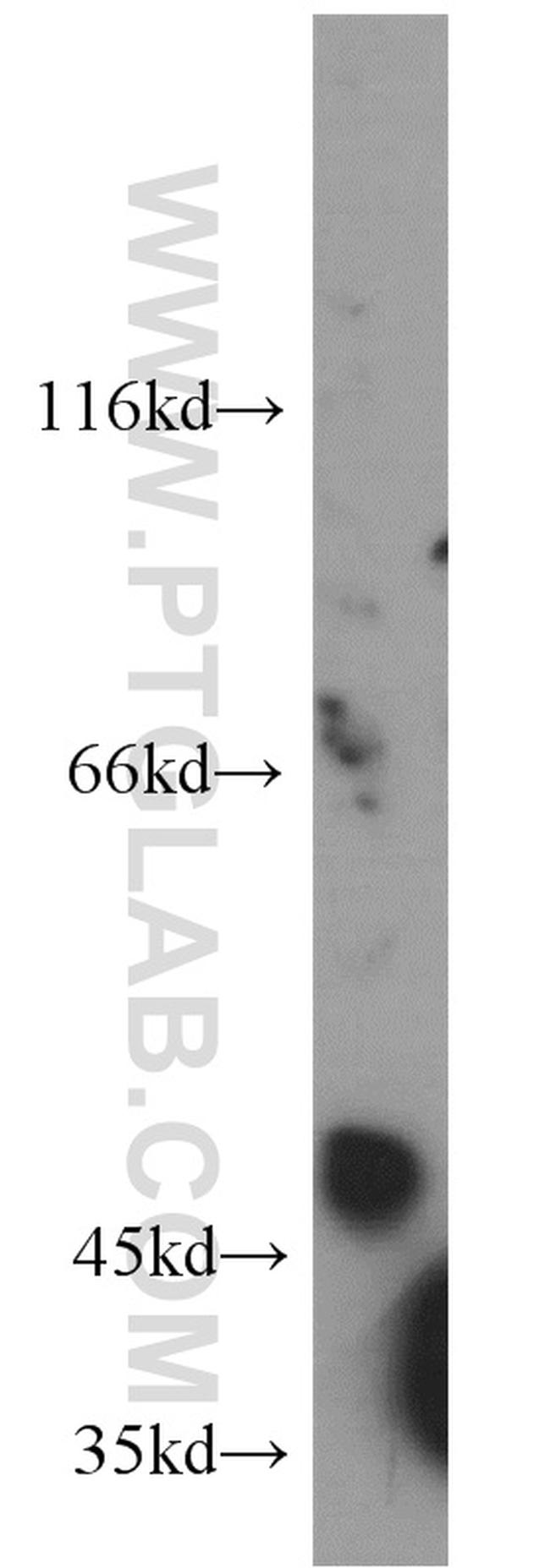 MT1-MMP Antibody in Western Blot (WB)