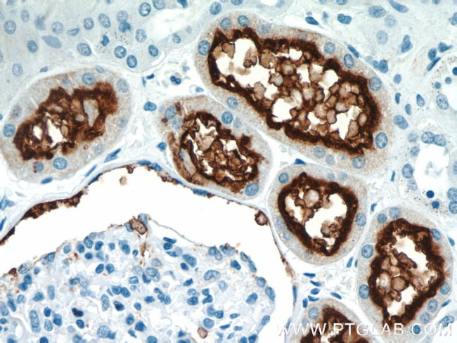 CD13 Antibody in Immunohistochemistry (Paraffin) (IHC (P))