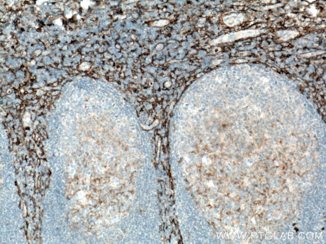 CD13 Antibody in Immunohistochemistry (Paraffin) (IHC (P))