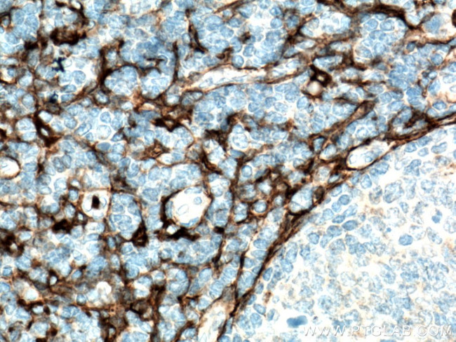 CD13 Antibody in Immunohistochemistry (Paraffin) (IHC (P))