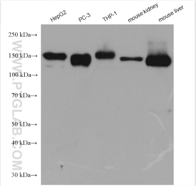 CD13 Antibody in Western Blot (WB)