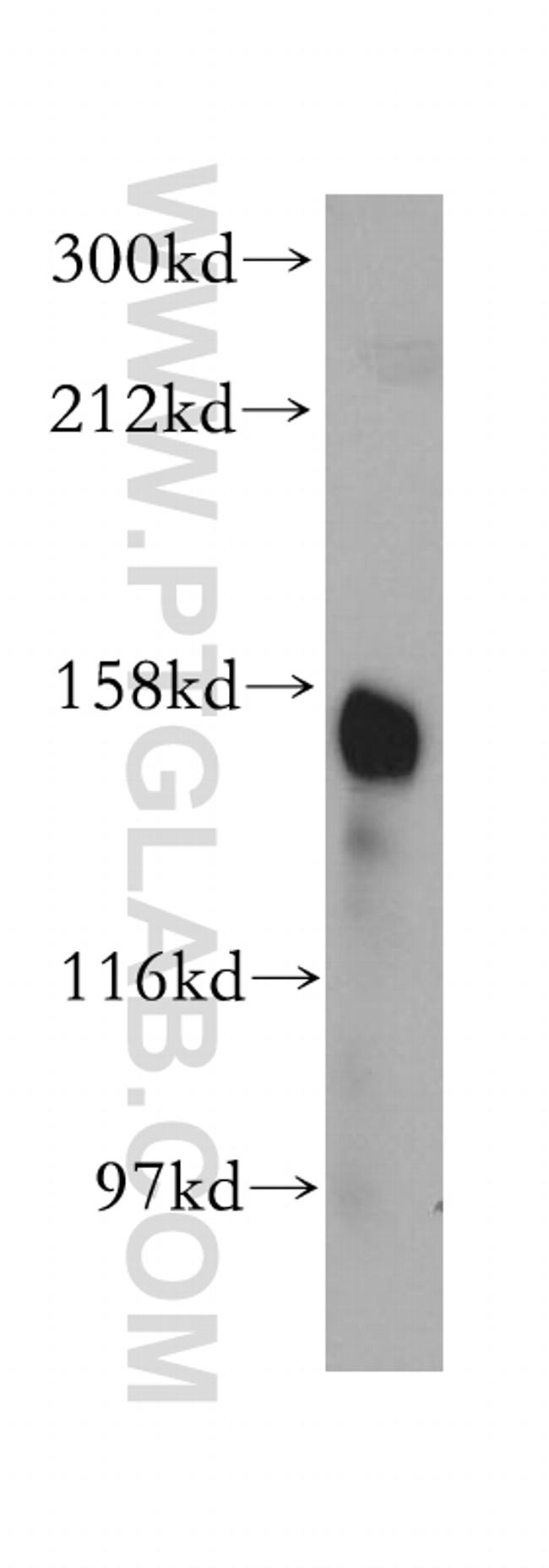 CD13 Antibody in Western Blot (WB)