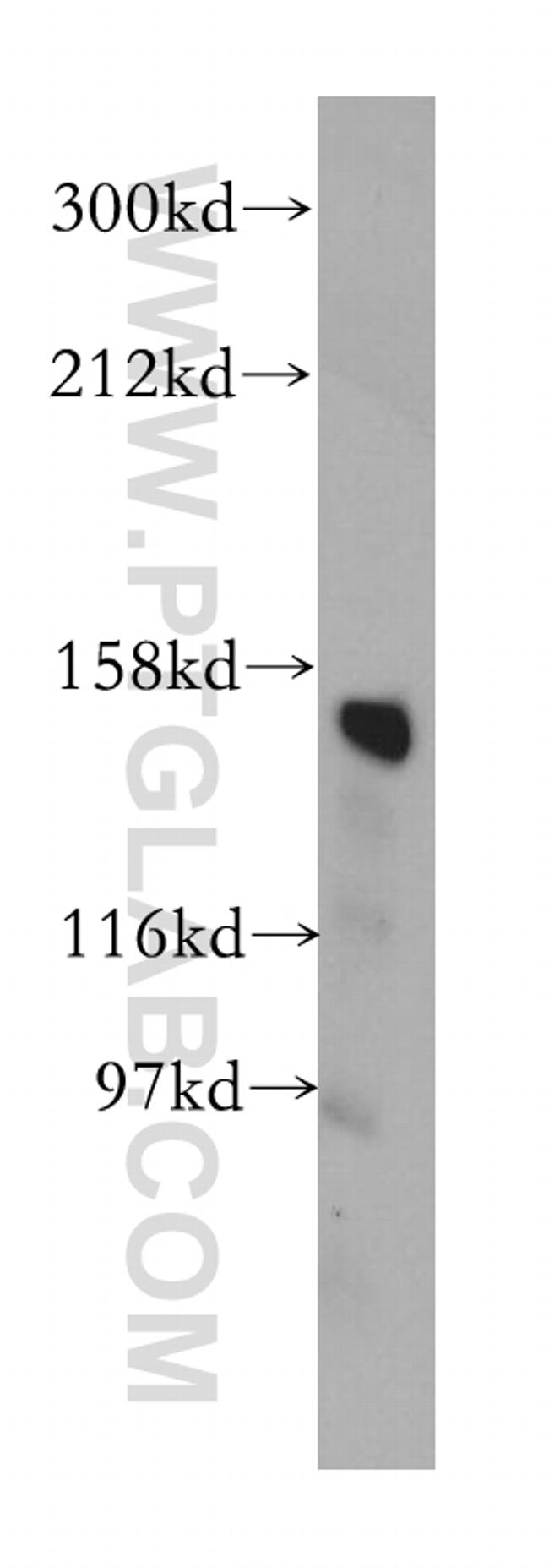 CD13 Antibody in Western Blot (WB)