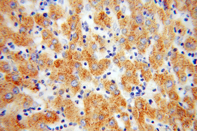 C1S Antibody in Immunohistochemistry (Paraffin) (IHC (P))