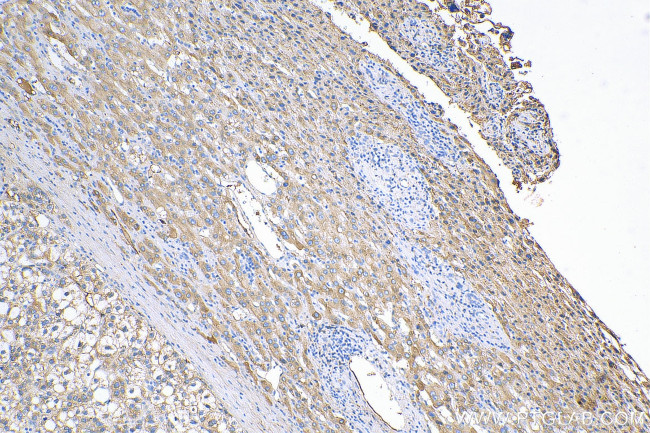 C1S Antibody in Immunohistochemistry (Paraffin) (IHC (P))