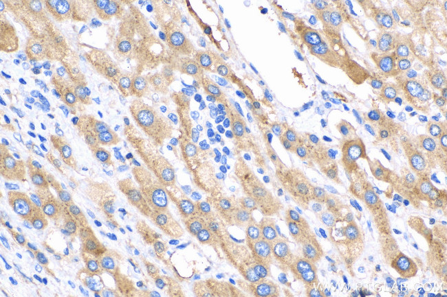 C1S Antibody in Immunohistochemistry (Paraffin) (IHC (P))