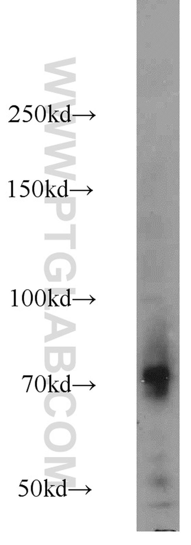 C1S Antibody in Western Blot (WB)