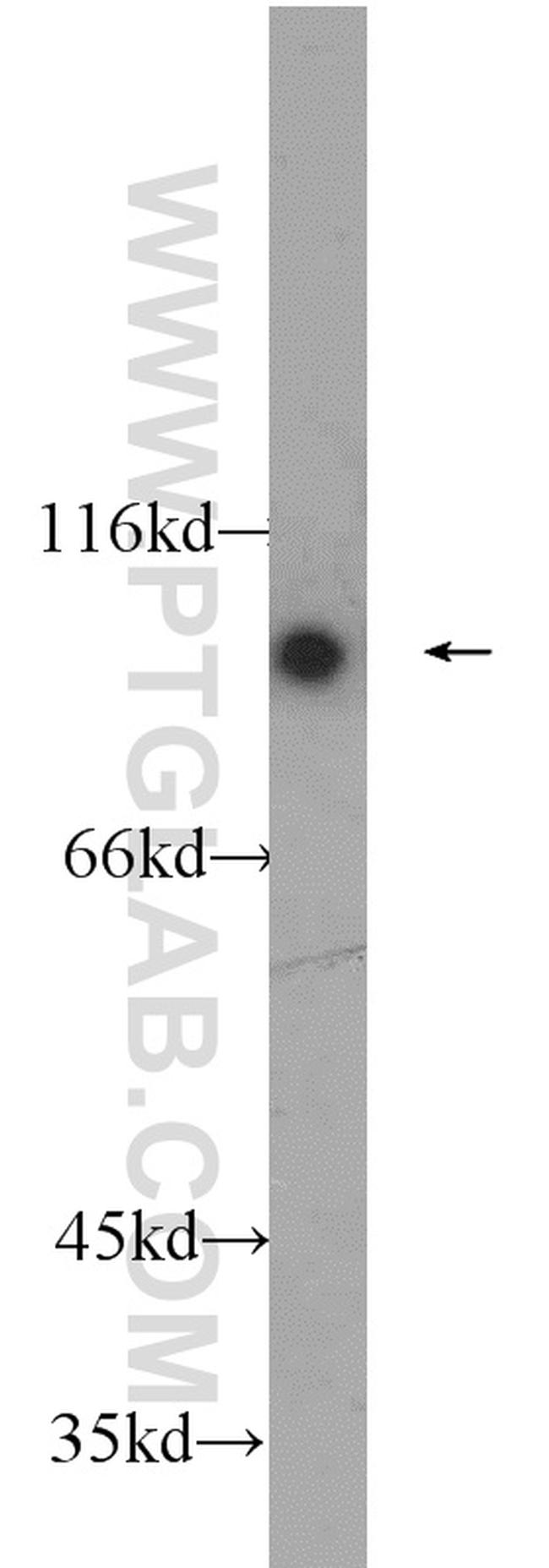 C1S Antibody in Western Blot (WB)