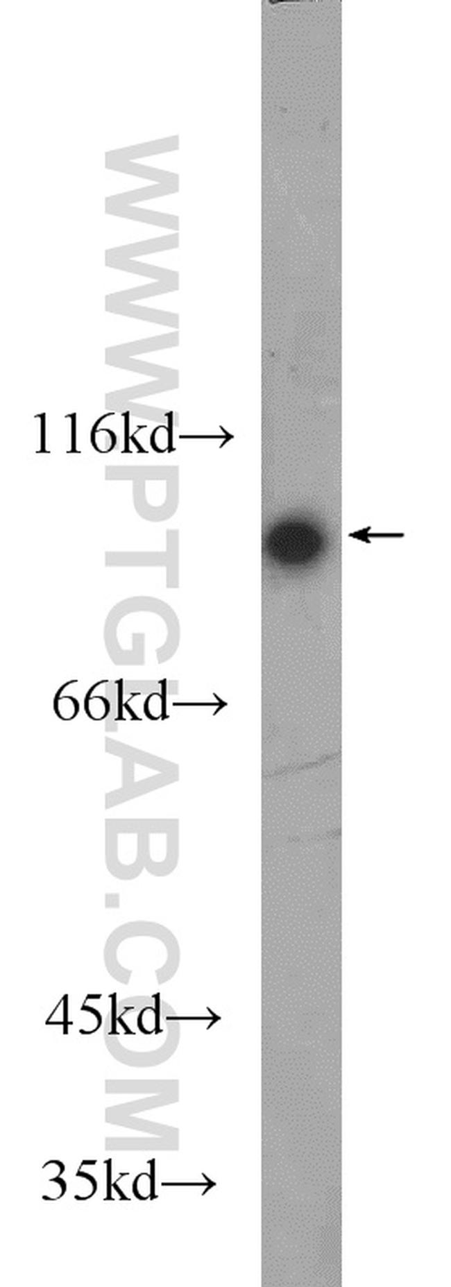 C1S Antibody in Western Blot (WB)