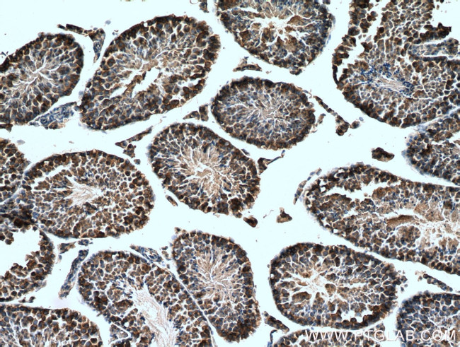 alpha Tubulin Antibody in Immunohistochemistry (Paraffin) (IHC (P))